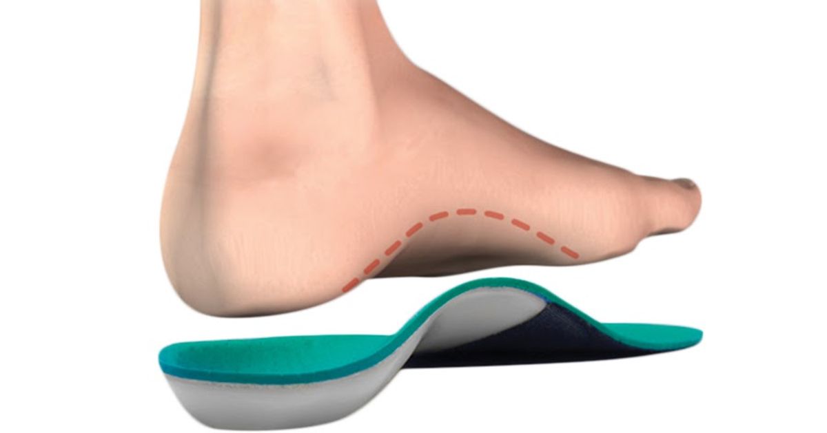 How Orthotics Can Alleviate Plantar Fasciitis Pain: A Closer Look at Foot Support Strategies