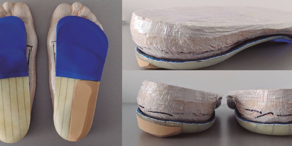 custom orthotics insoles feet support