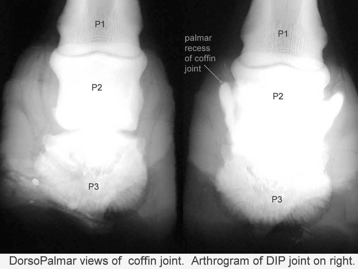 Unraveling the Biomechanics of the Foot: How Structure Influences Function